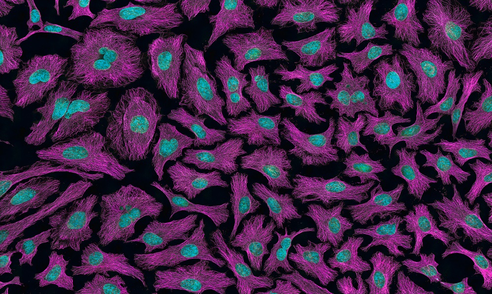 Lenvatinib (Lenvima)