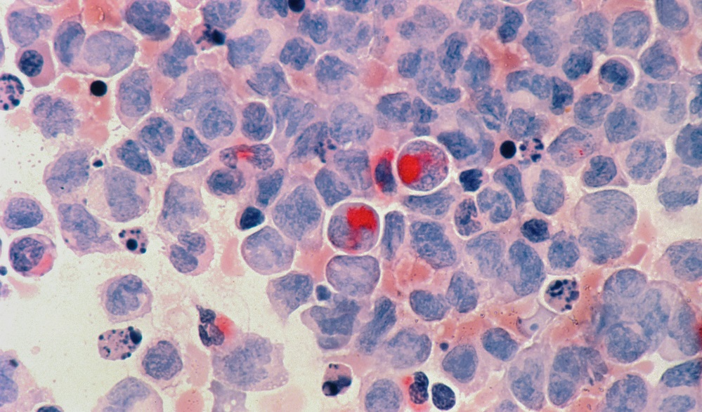 Palbociclib